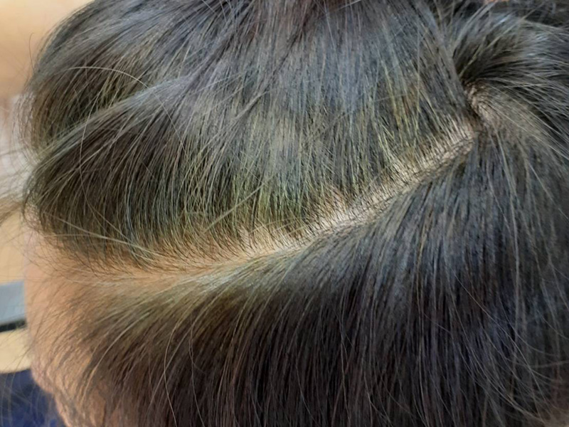 エイジングケア