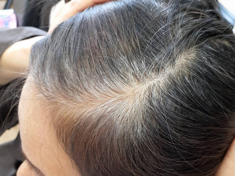 エイジングケア